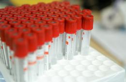 22.06.2021 Ежесуточный показатель заболеваемости COVID-19 в Приморье преодолел отметку в 100 человек, сообщает http://www.primorsky.ru | Администрация муниципального округа город Партизанск Приморского края Официальный сайт